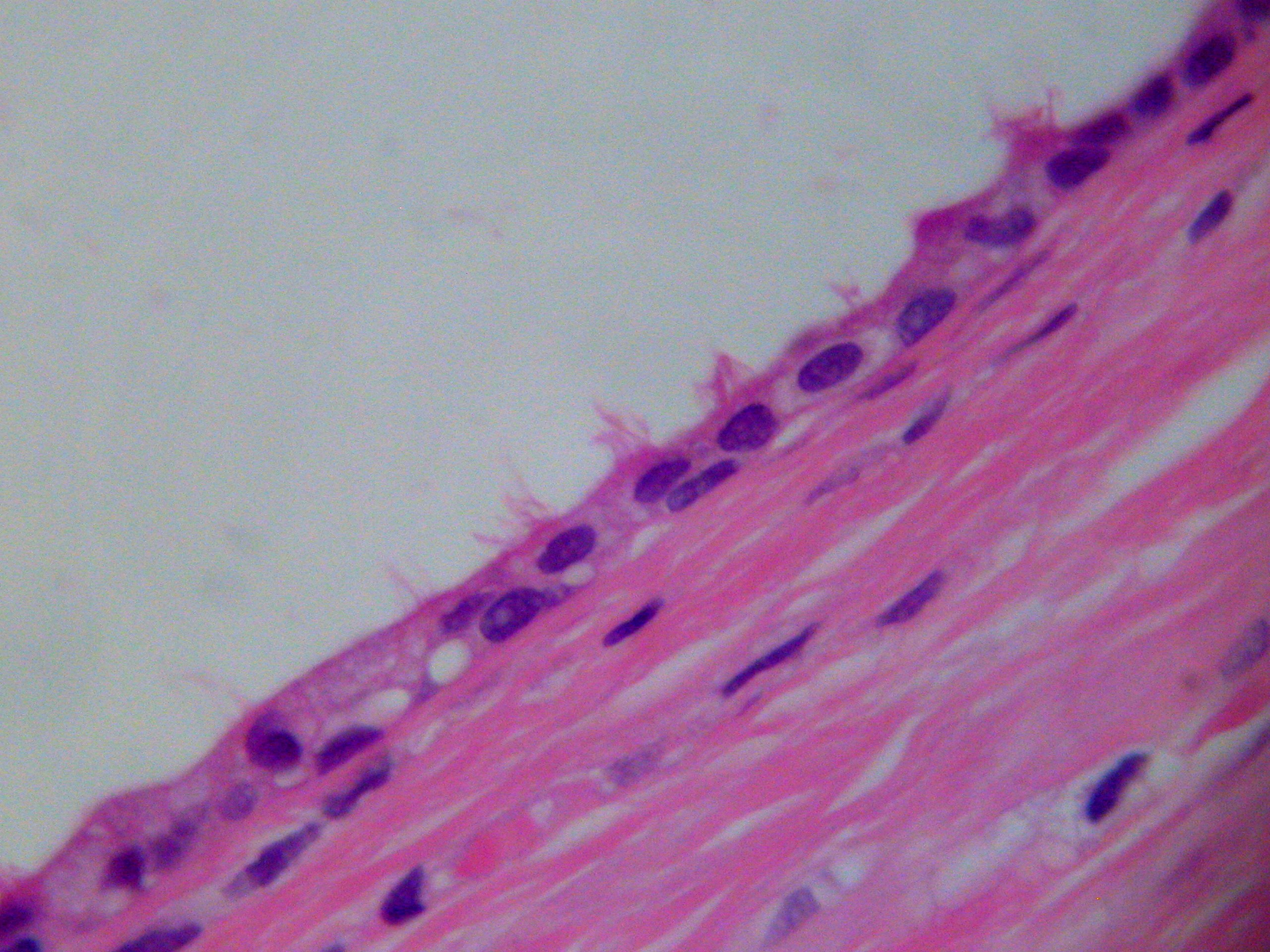 figura 1 - Caso 1.  Detalle del revestimiento epitelial con clulas ciliadas